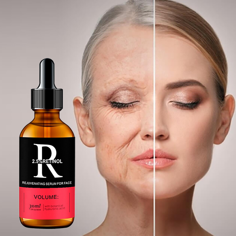 Retinol Vitamin A Cream - フェイスセラム,ビタミンC,ヒアルロン酸,フェイシャルエッセンス,しわ防止,美白,にきび除去,毛穴の引き締め