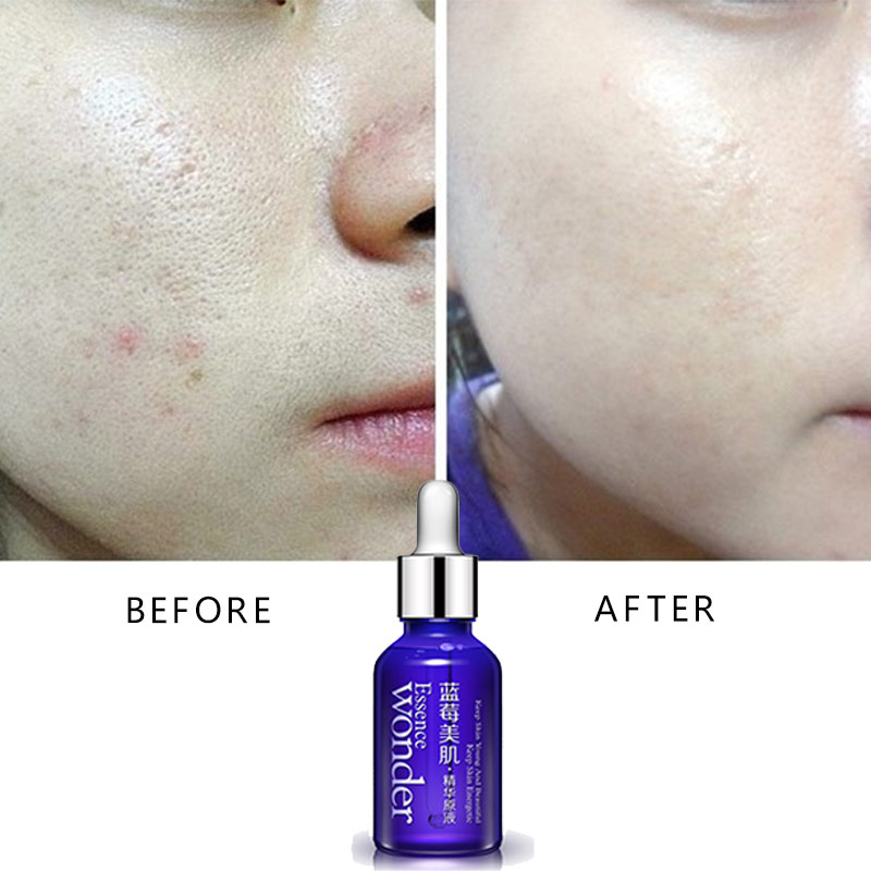 バイオアワ-ブルーベリーフェイシャルリフティングセラム,スキ - Skincare Bioaqua のレビューと価格