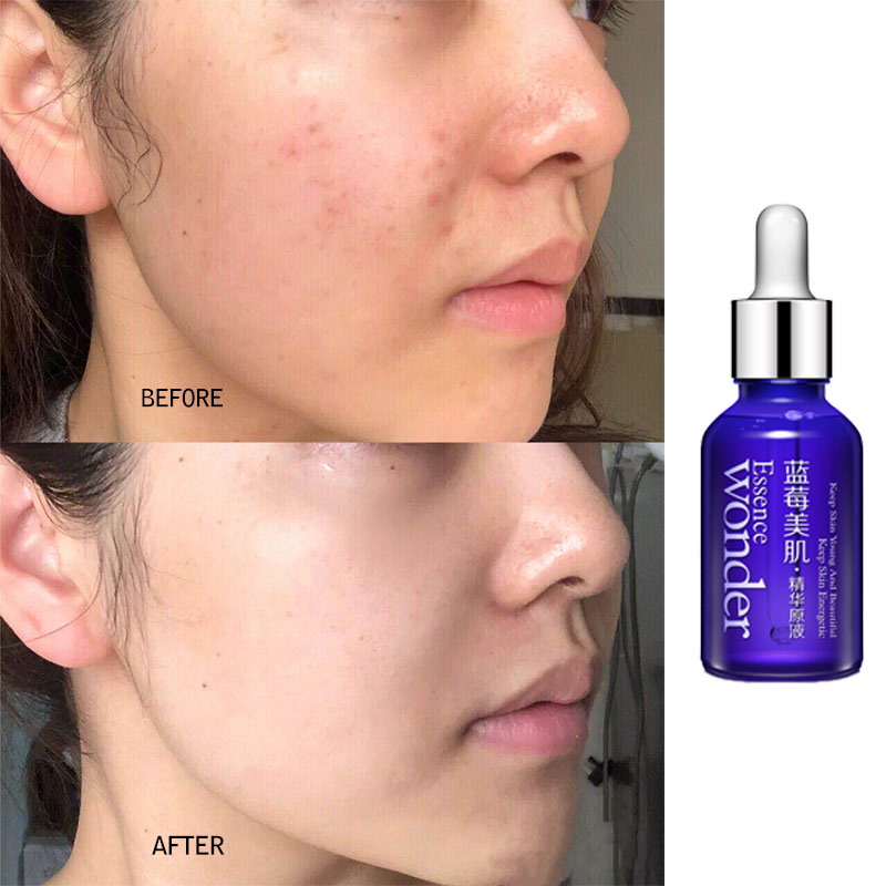 バイオアワ-ブルーベリーフェイシャルリフティングセラム,スキ - Skincare Bioaqua のレビューと価格