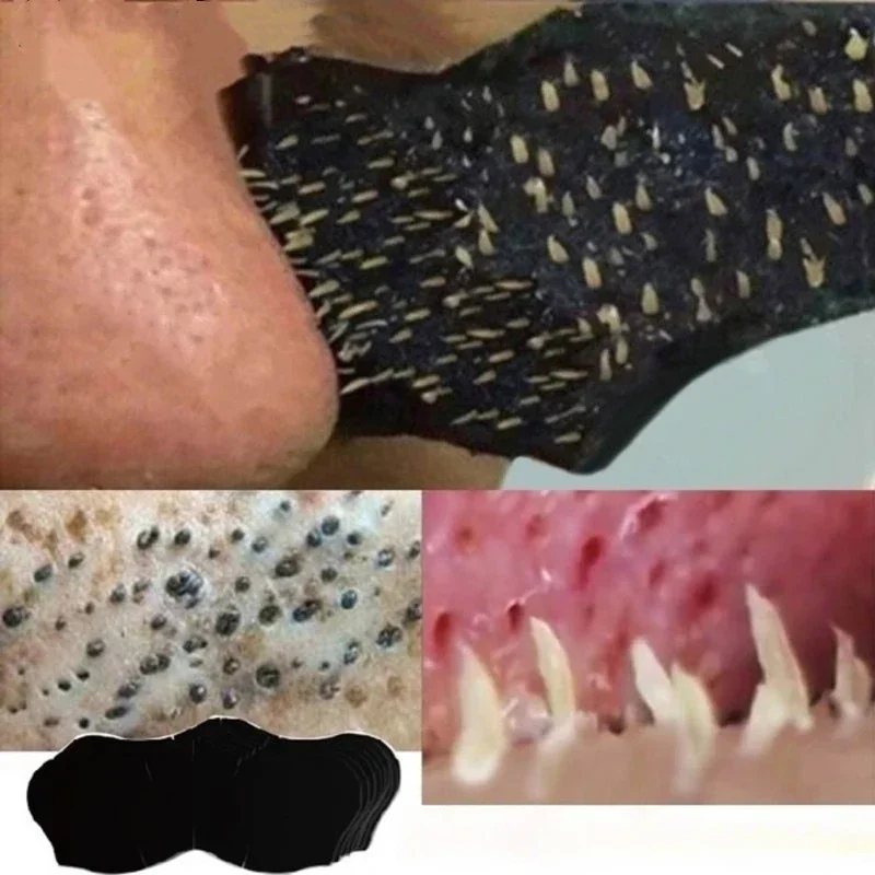 にきび除去マスク,鼻ストリップ,スキンケアパッチ,毛穴除去剤 - Skincare Viral Tiktok のレビューと価格
