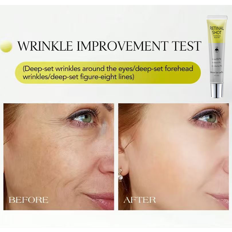 レチナル0.1% インテンシブショット パンテノール1% ヒ - Retinol Vitamin A Cream のレビューと価格