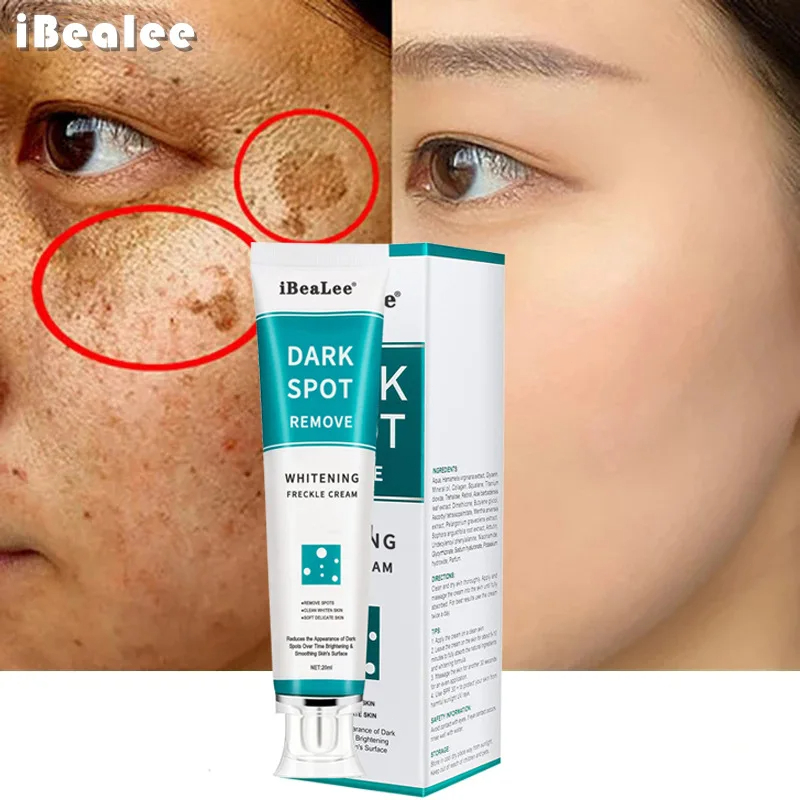 そばかすや色素沈着のための色素沈着のための美白クリーム,暗い - Skincare Glowing のレビューと価格